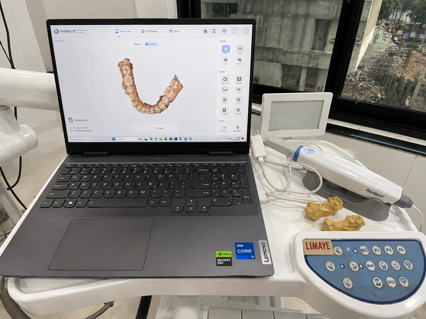 Digital diagnostic equipment